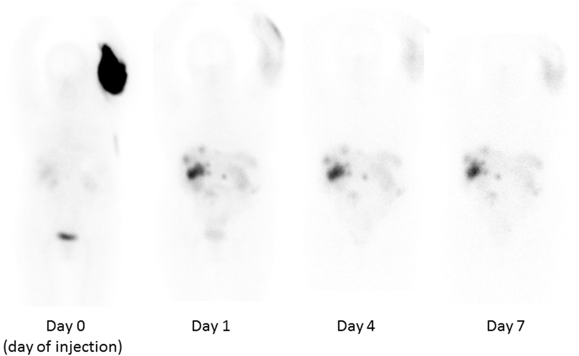 Fig. 1