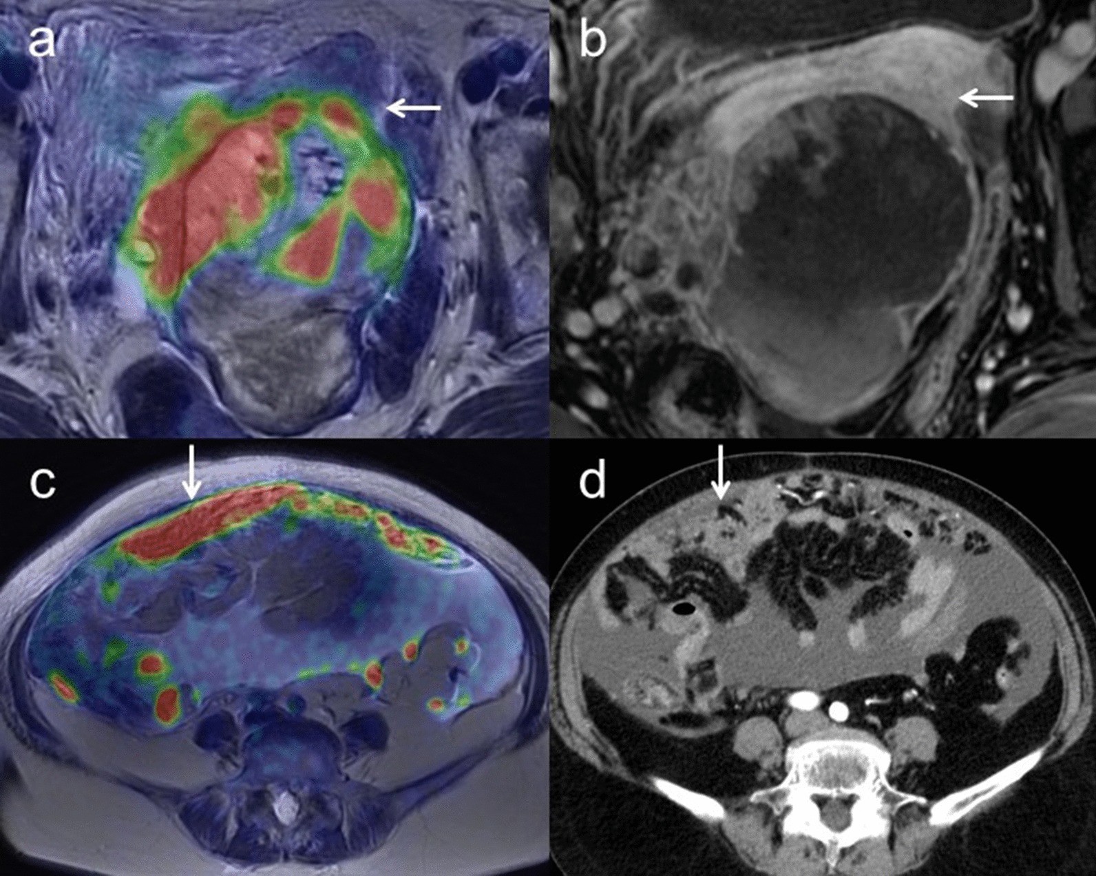 Fig. 2