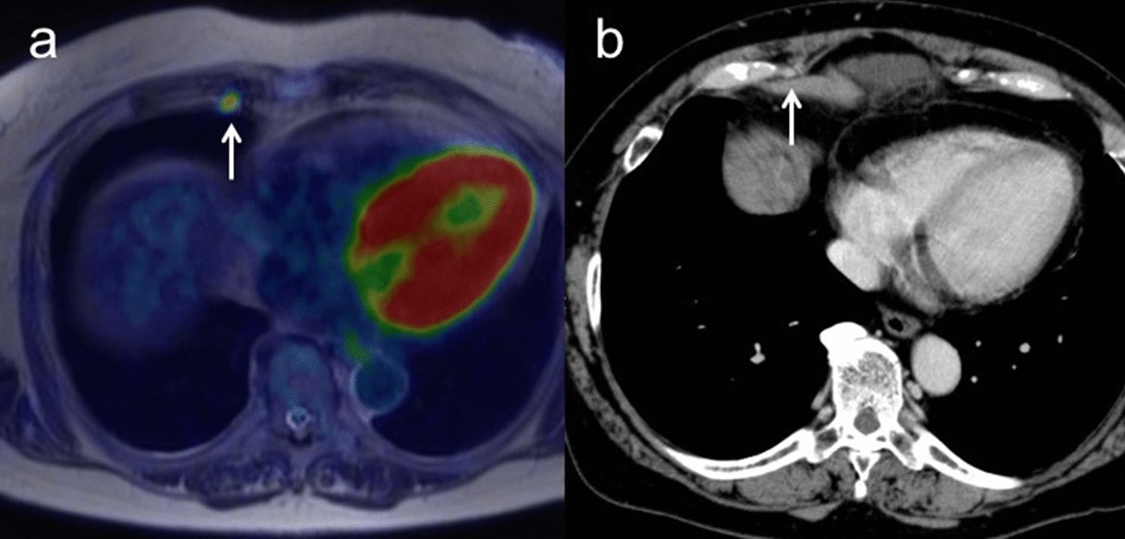 Fig. 4