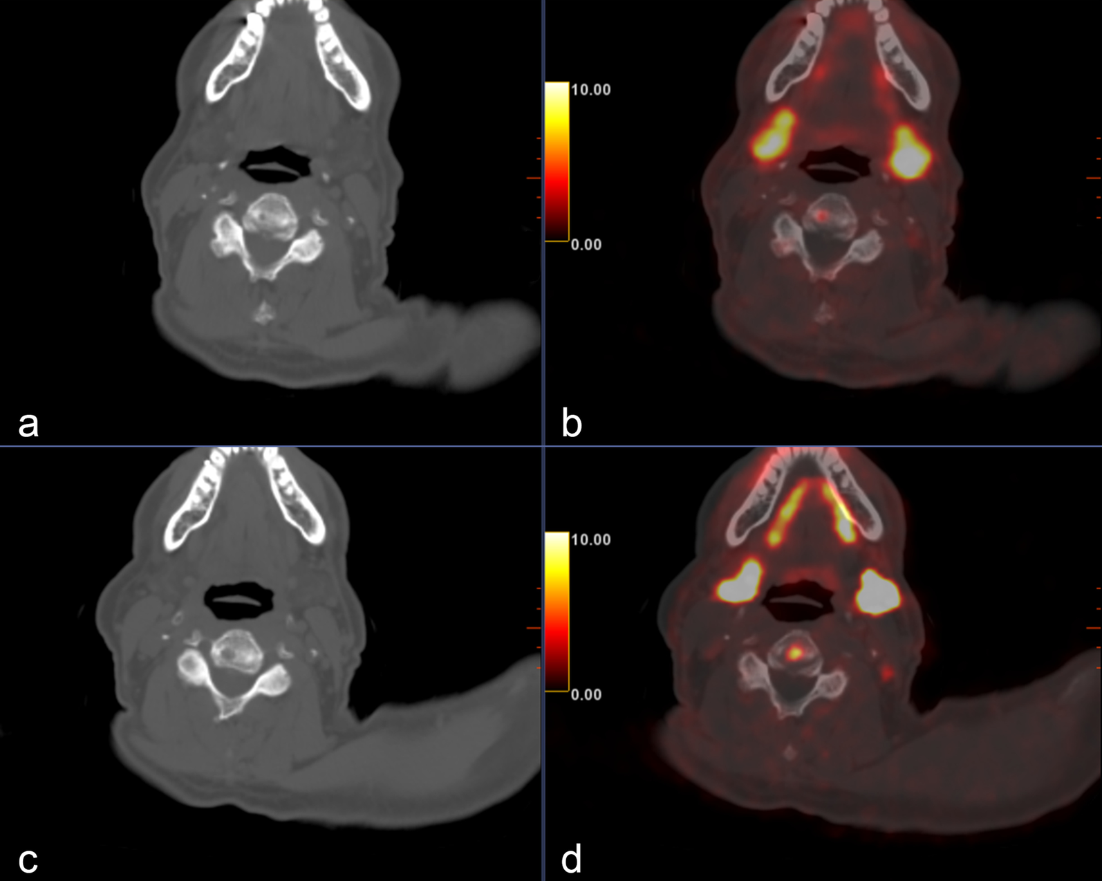 Fig. 2