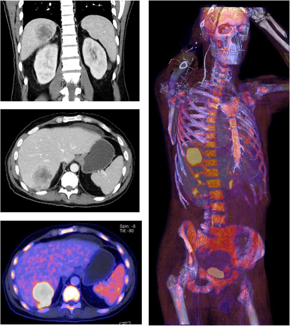 Fig. 2