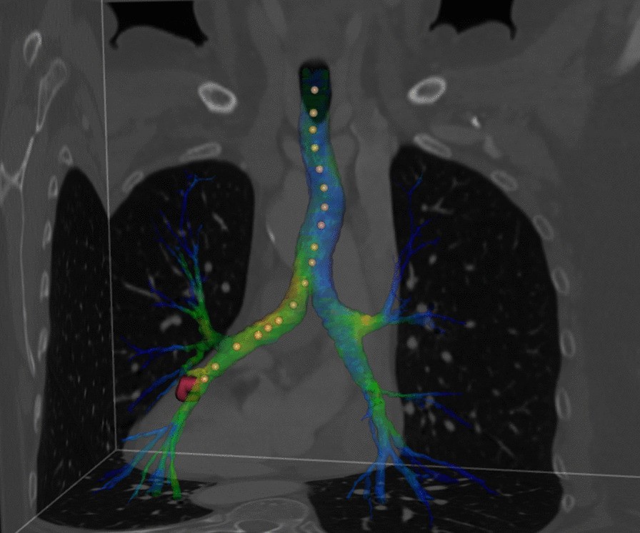 Fig. 2