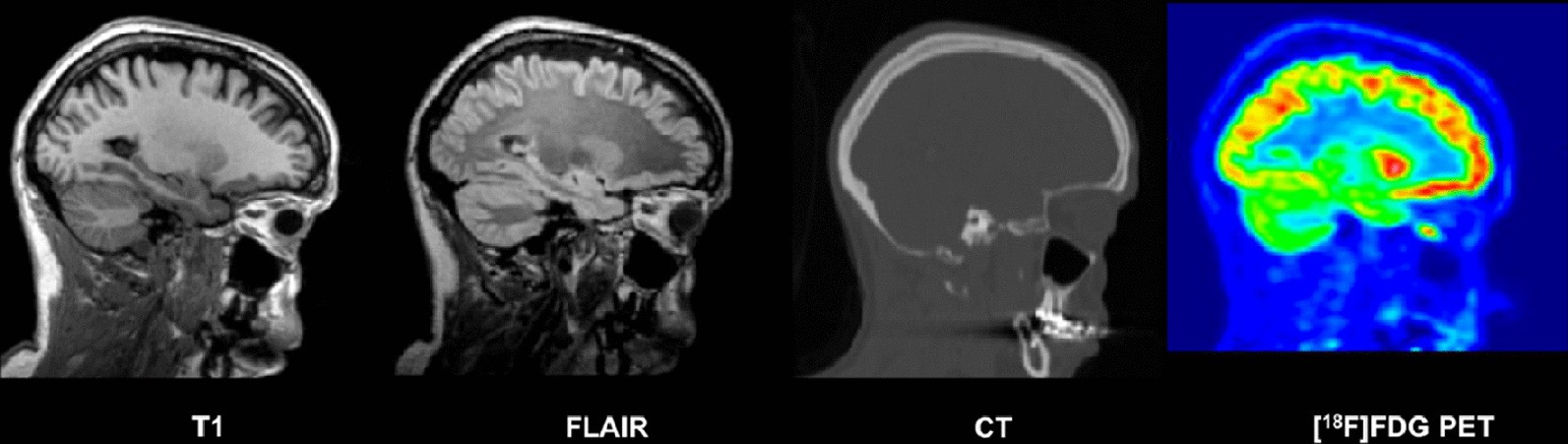 Fig. 1