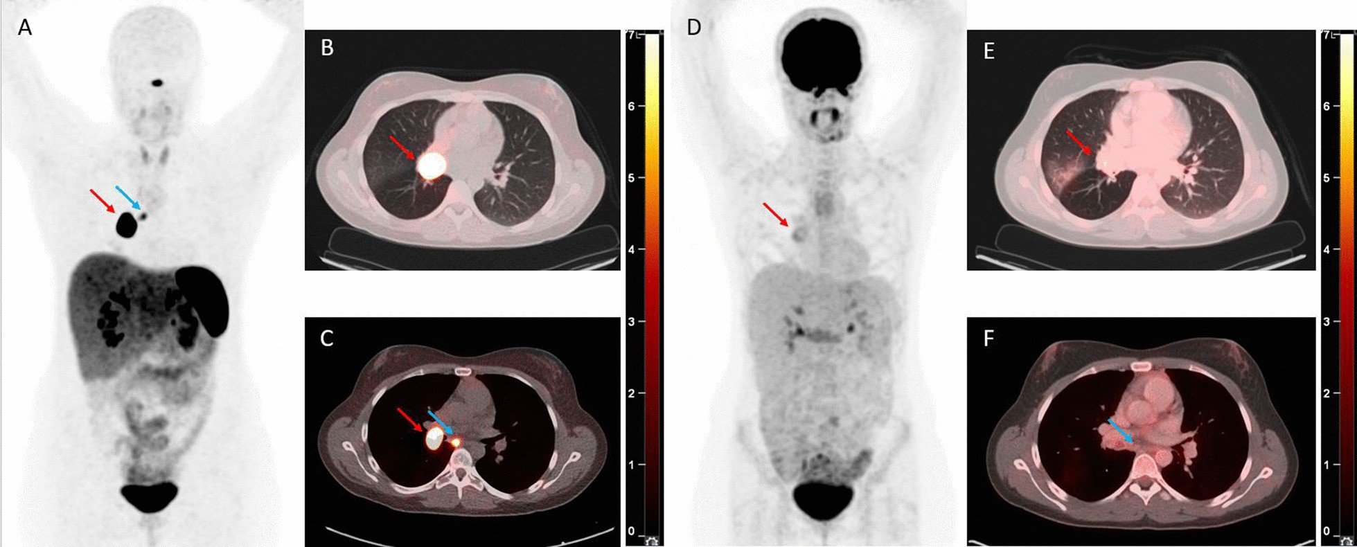 Fig. 4