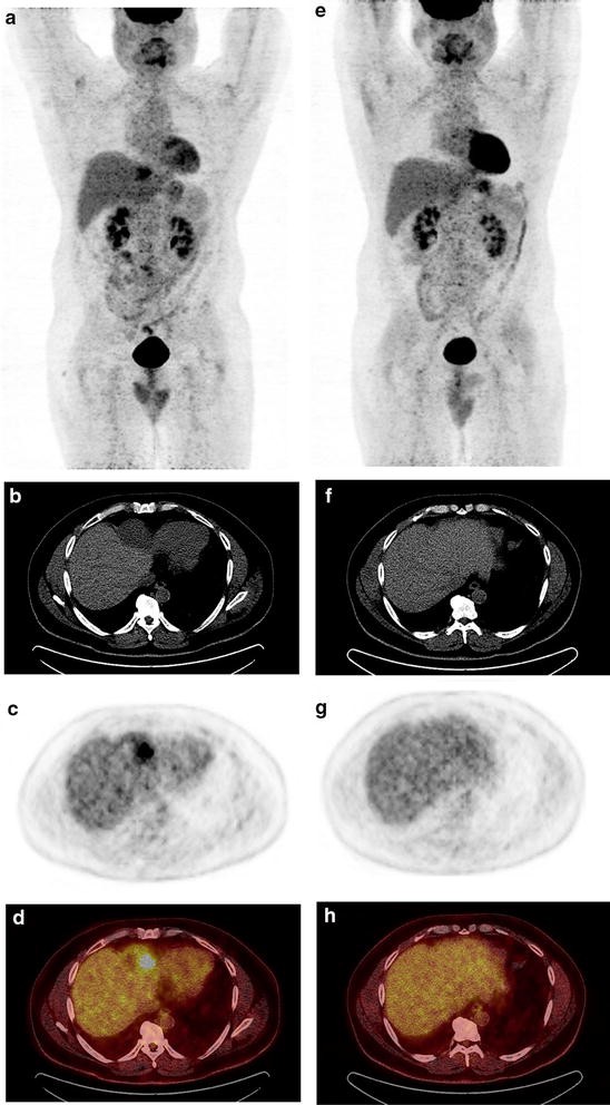 Fig. 2