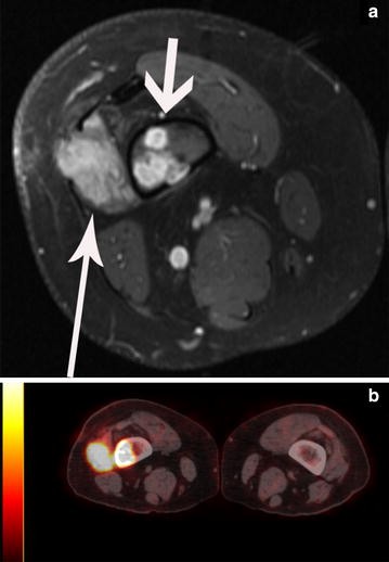 Fig. 2