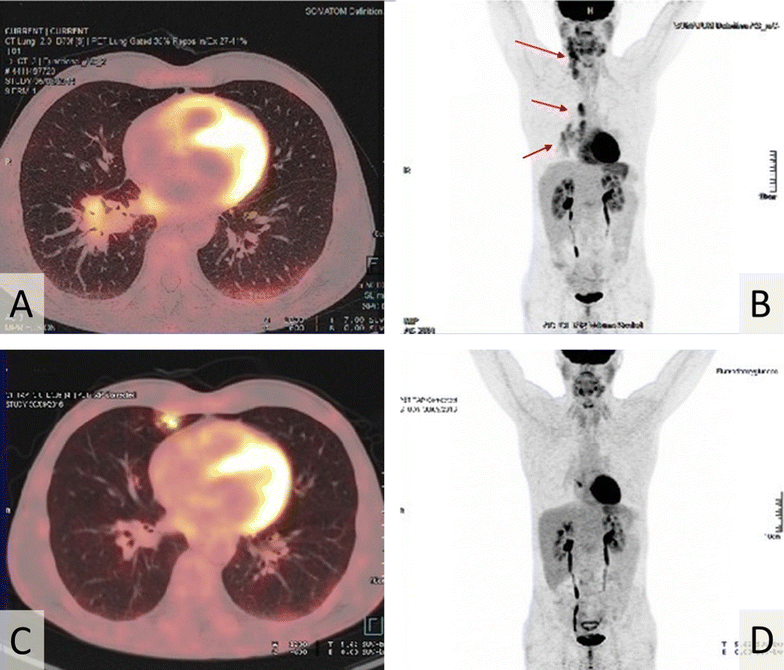 Fig. 1