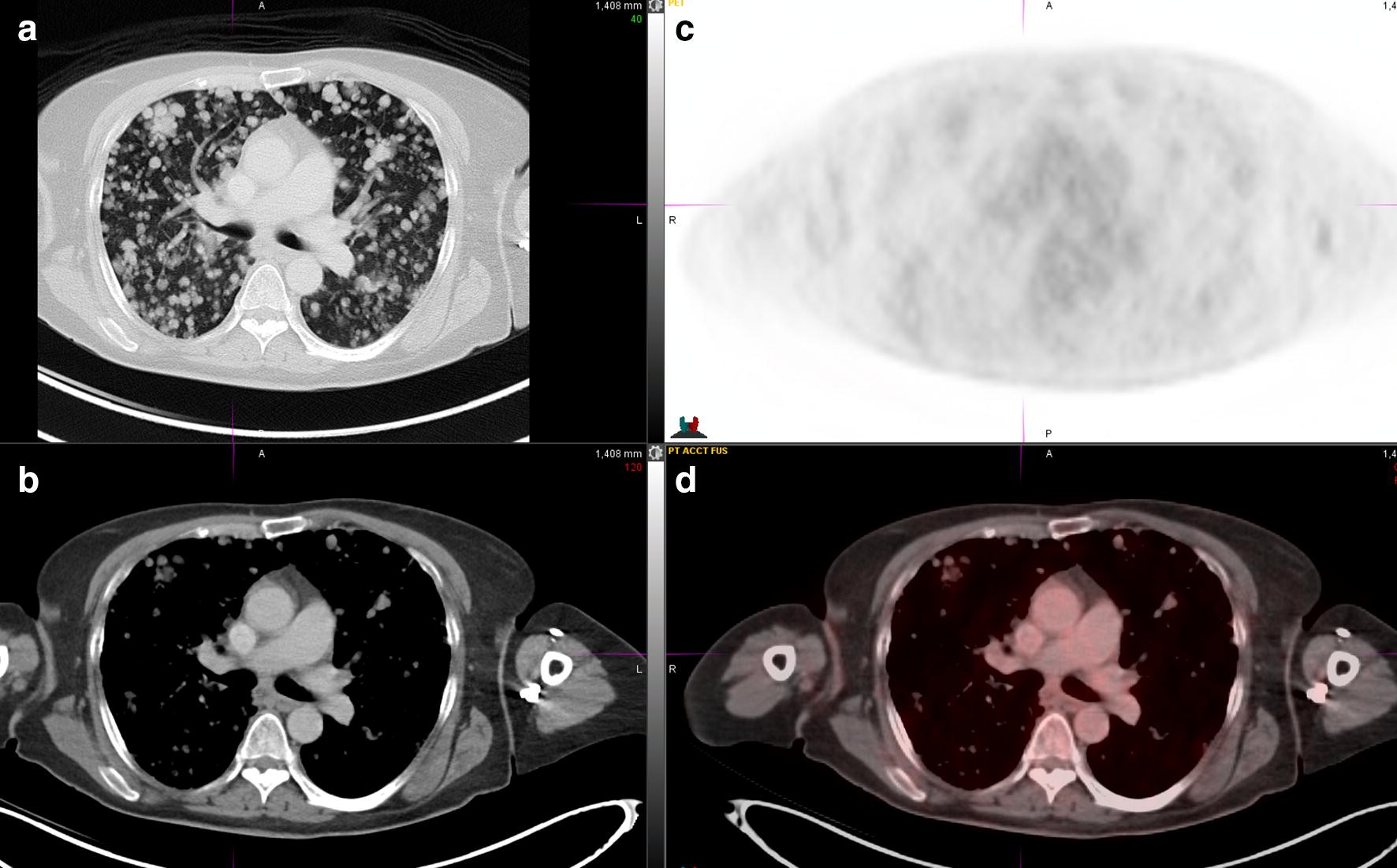 Fig. 2