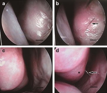 Fig. 3