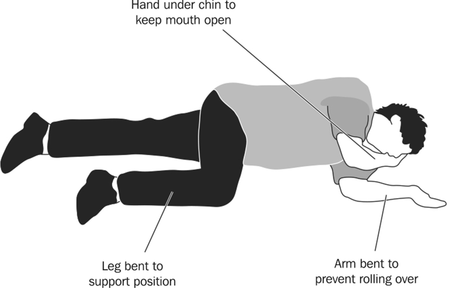 Fig. 1