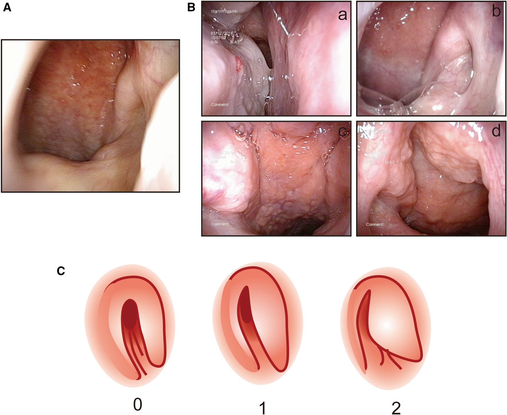 Fig. 1