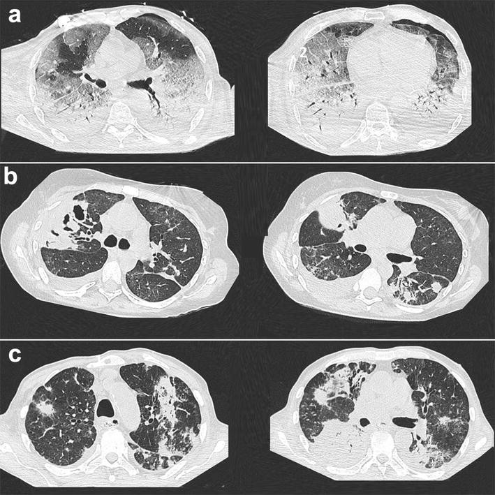 Fig. 2