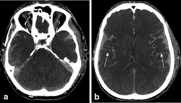 Fig. 3