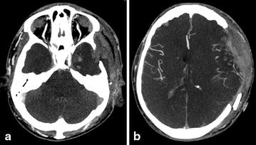 Fig. 4