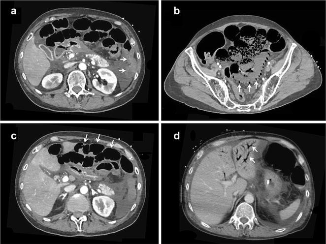 Fig. 1