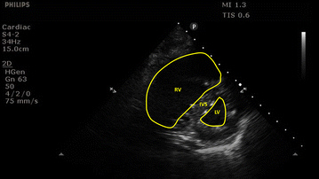 Fig. 1