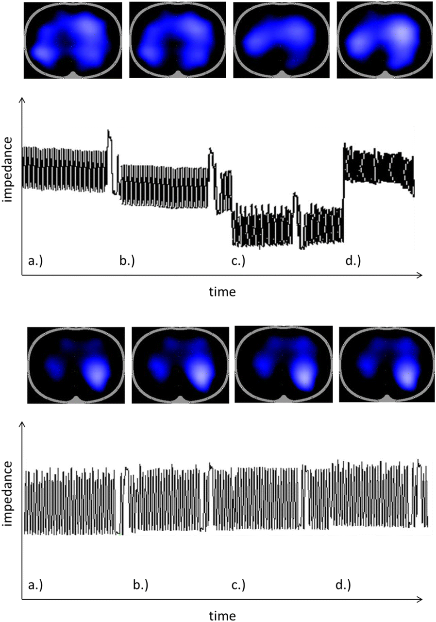 Fig. 1