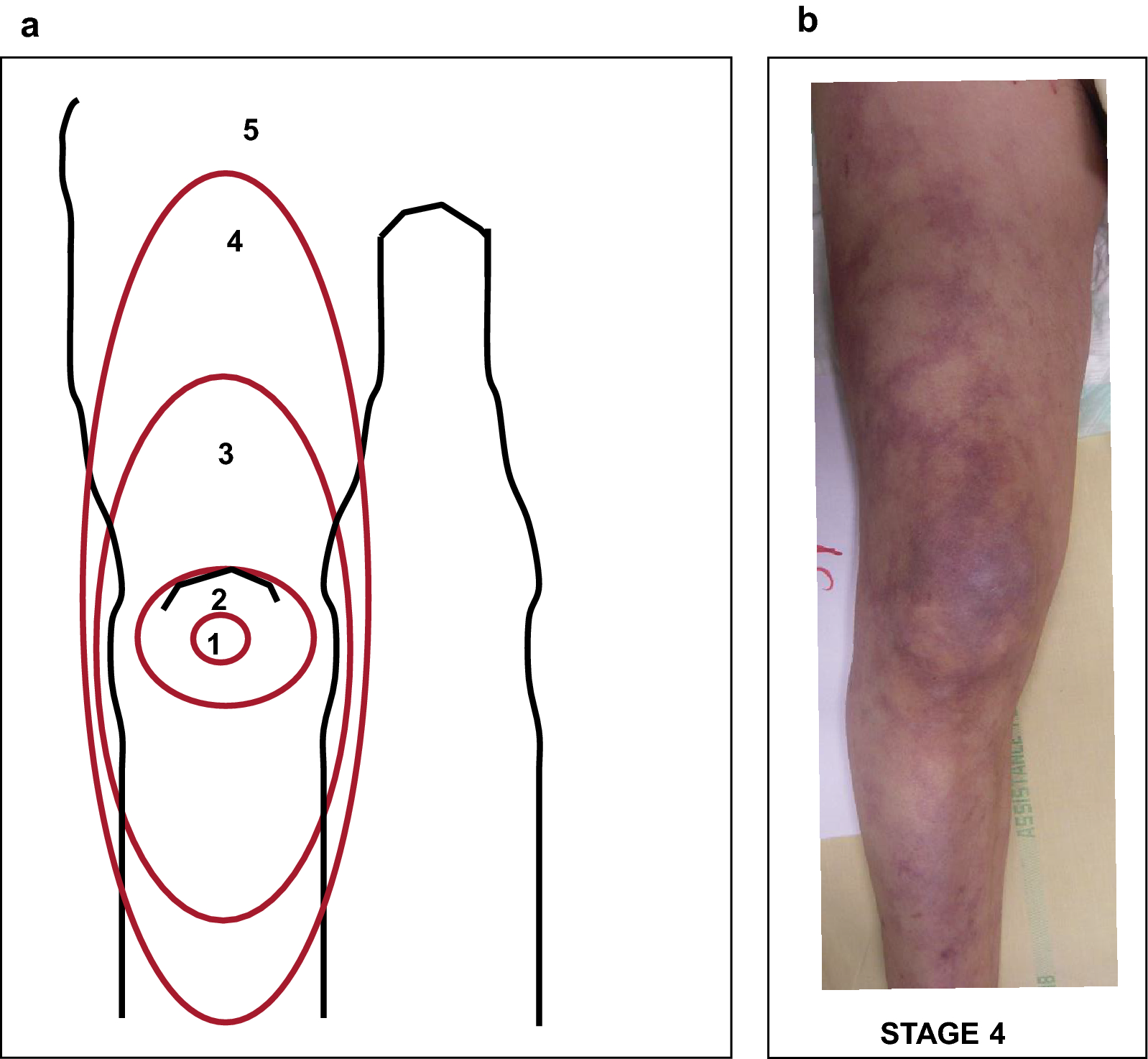 Fig. 4