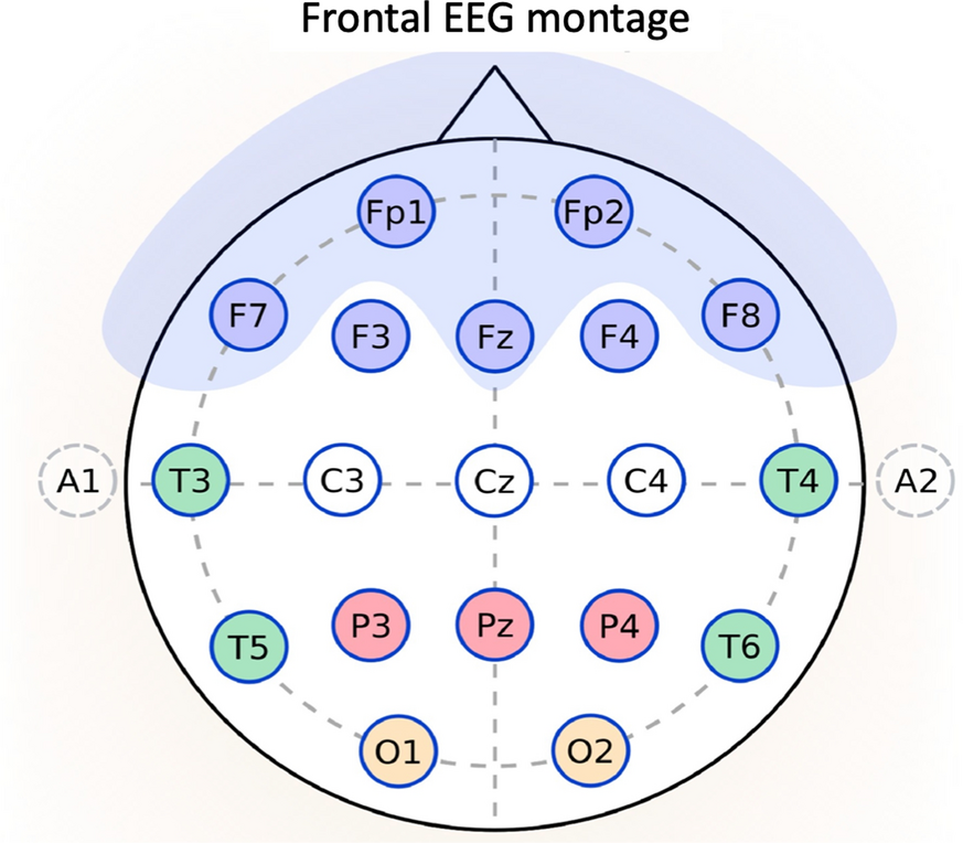 Fig. 1