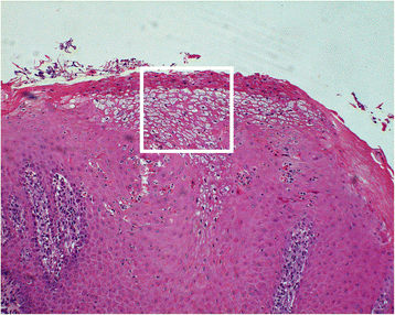 Fig. 10