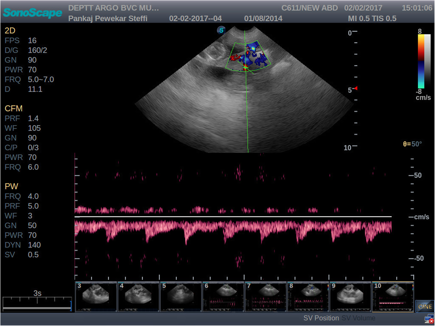 Fig. 1