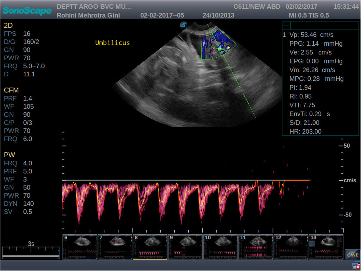 Fig. 2