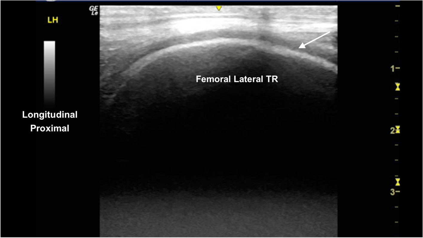 Fig. 12