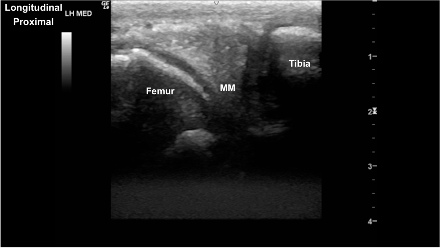 Fig. 15