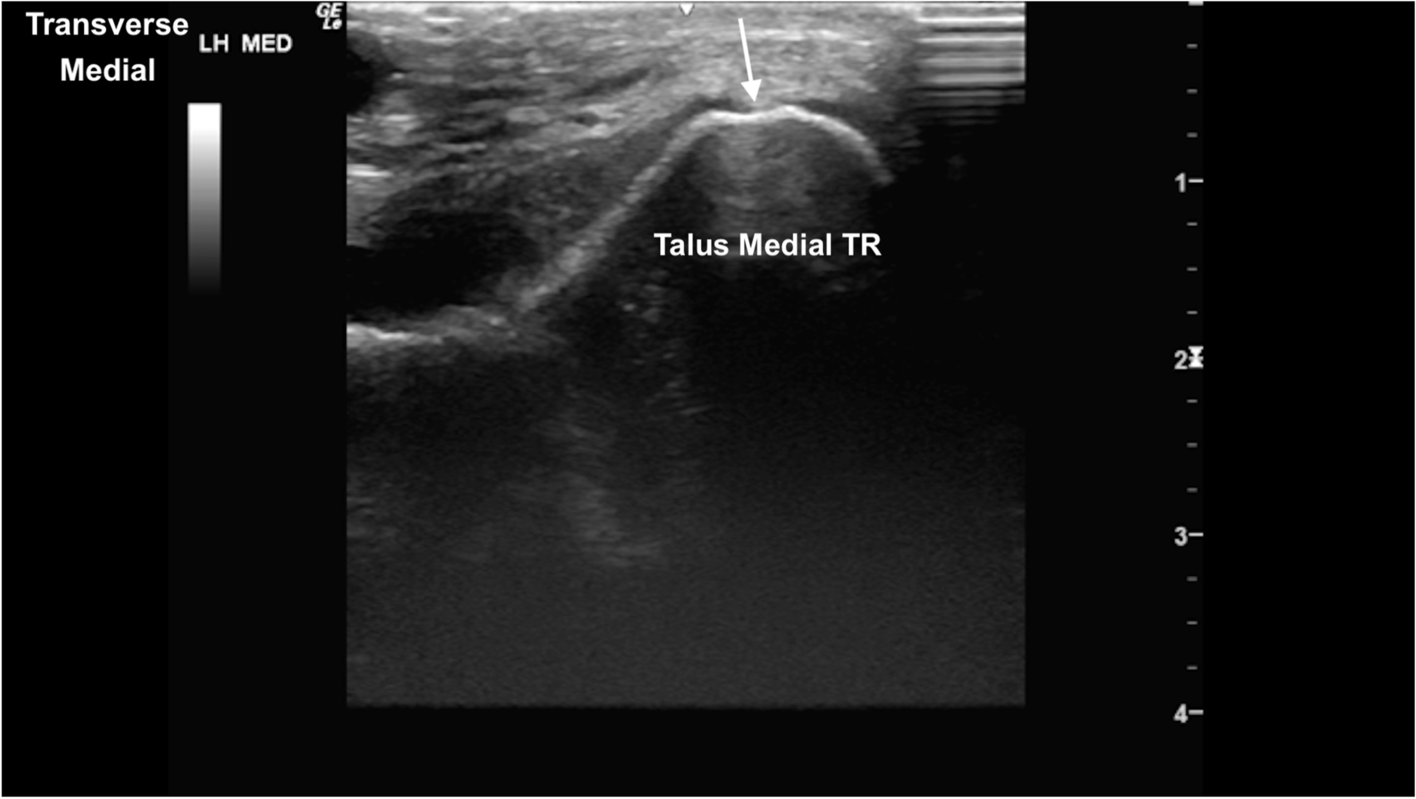 Fig. 17