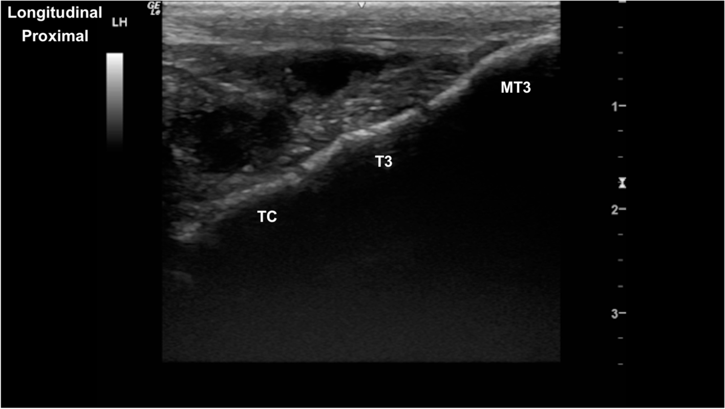 Fig. 18