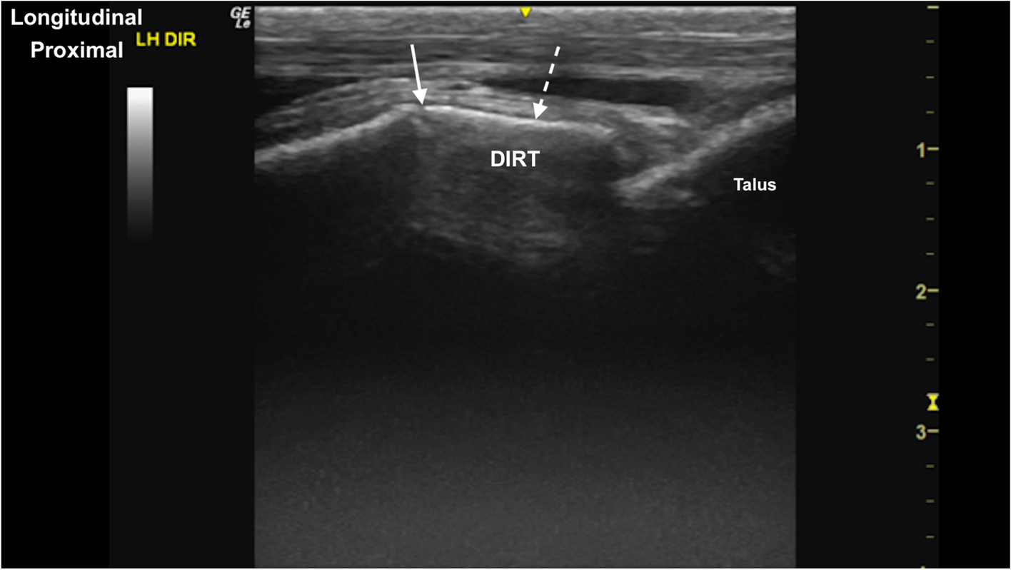 Fig. 20