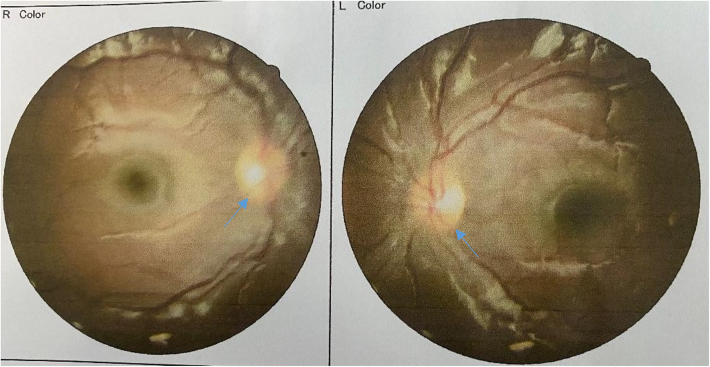 Fig. 2