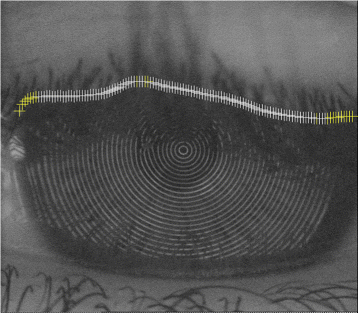 Fig. 14