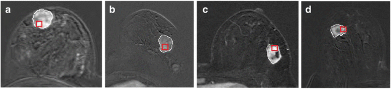 Fig. 11