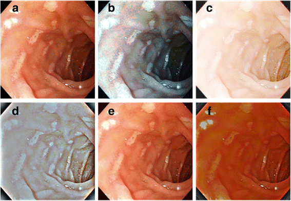 Fig. 10