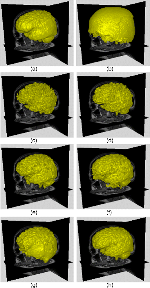 Figure 12