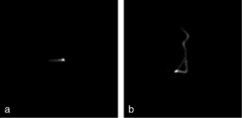 Fig. 15