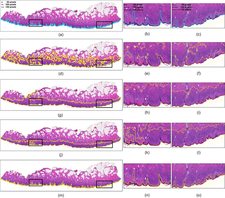 Fig. 15