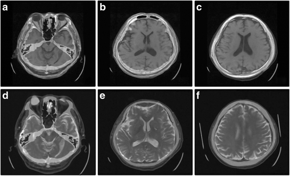 Fig. 18