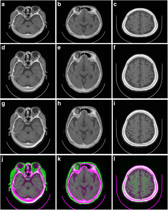 Fig. 20