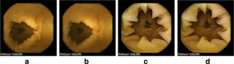 Fig. 2