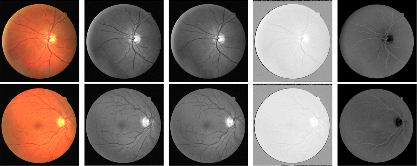 Fig. 2