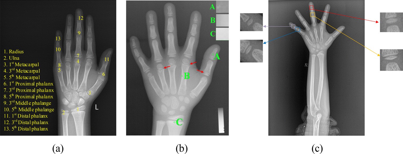 Fig. 2