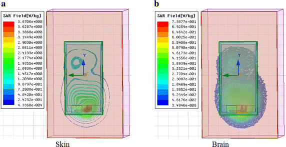 Fig. 33