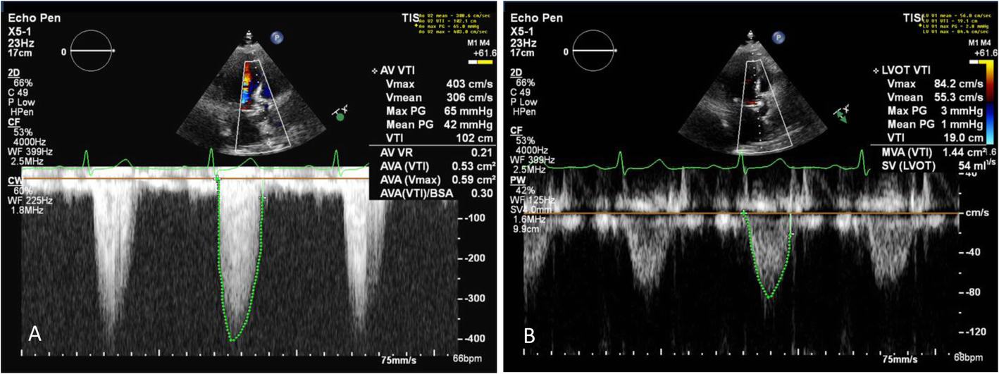 Fig. 2