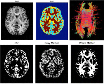 Fig. 22 (abstract A23).