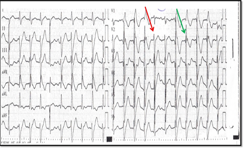 Fig. 2