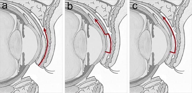 Fig. 4