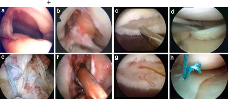 Fig. 2