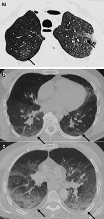 Fig. 1